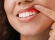 Gum Disease Treatment Alexandria VA Dr. Benson Clark. King Center Dental. General, Cosmetic, Restorative Dentistry. Dentist in Alexandria VA 22315