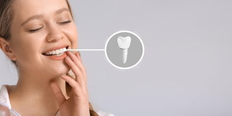 12 Fascinating Facts About Dental Implants | King Centre Dental ...