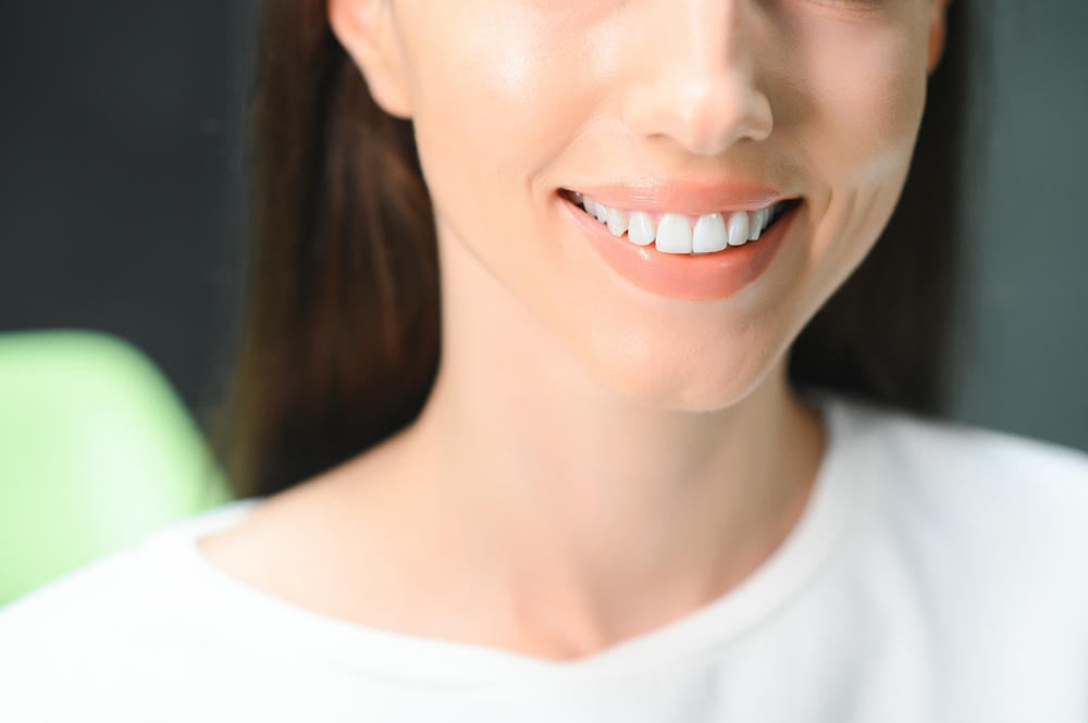Beautiful,Smile.,Closeup,Portrait,Of,Beautiful,Happy,Young,Woman,With Dental Exams Alexandria